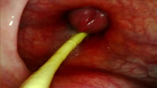 EXTREME ANAL POINT OF VIEW. WEB-CAM INSIDE HER BUTT-HOLE AS I POUND HER WITH MY MONSTROUS MEAT AND SPUNK DEEP INSIDE