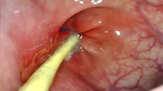 EXTREME ANAL POINT OF VIEW. ONLINE CAM INSIDE HER ANUS AS I POUND HER WITH MY GIGANTIC MEAT AND SPERM DEEP INSIDE